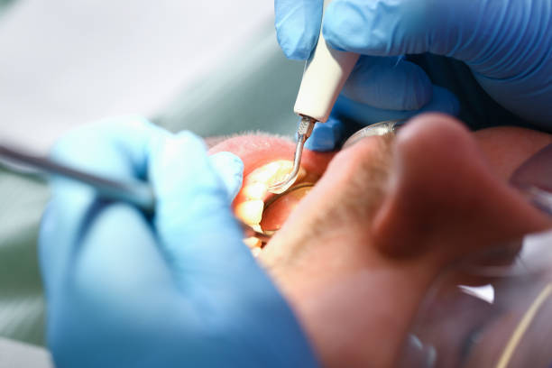 Best Emergency Treatment for Jaw Pain or Injury in Fruita, CO