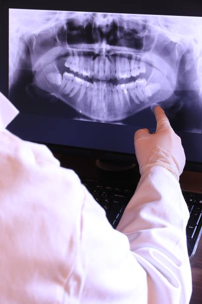 Best Dental Abscess Treatment in Fruita, CO